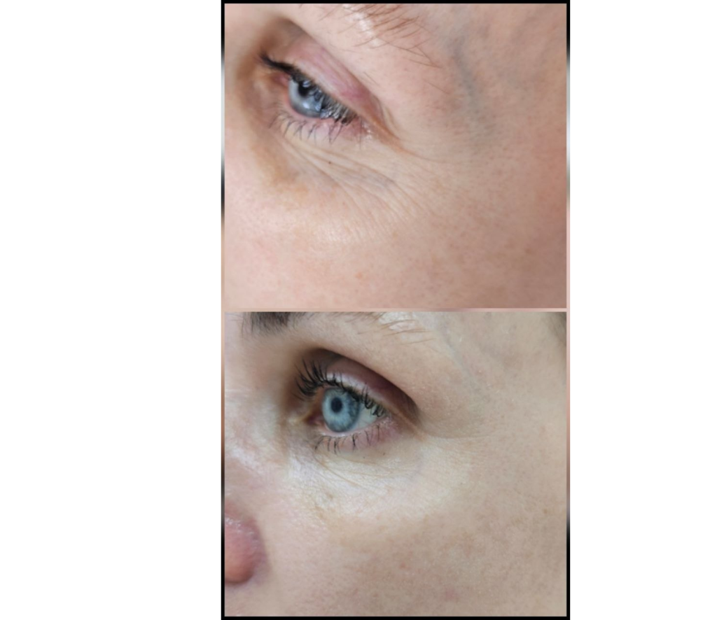 Результат применения #1