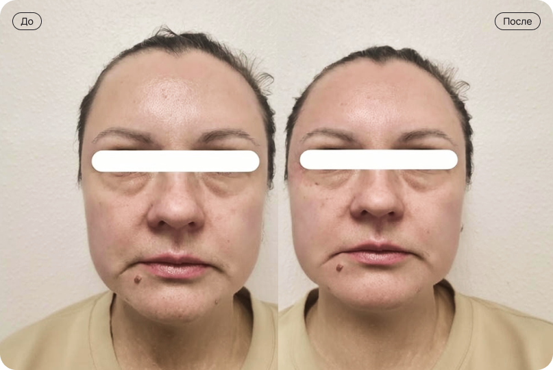 Результат применения #1