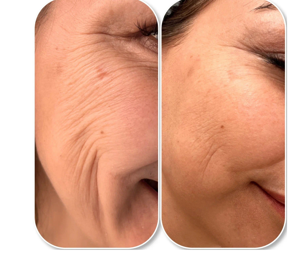 Результат применения #1