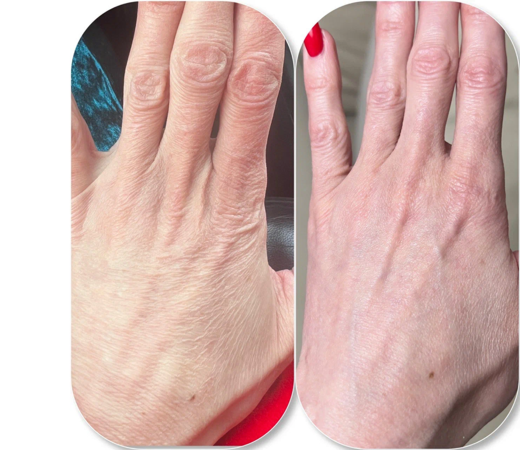 Результат применения #1